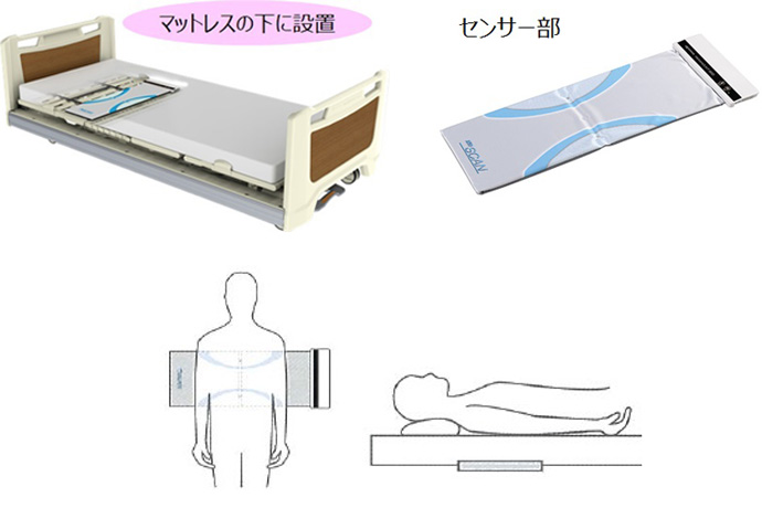 眠りＳＣＡＮの導入